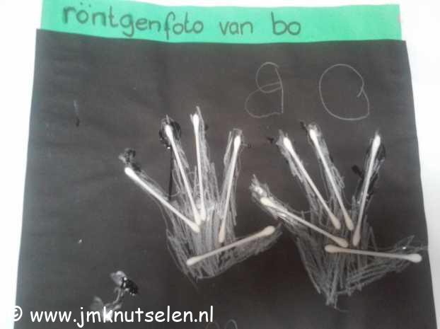 R�ntgenfoto
